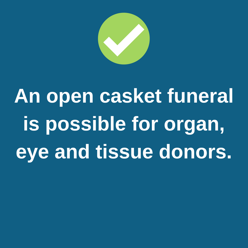 Anopencasketfuneralispossiblefordonors Donor Alliance