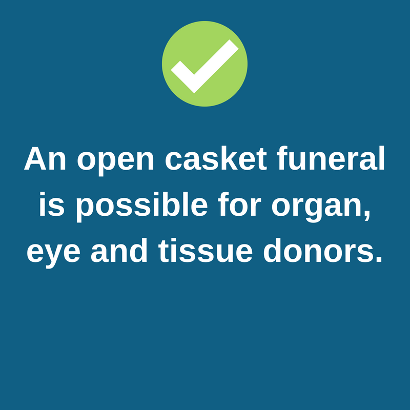 An-open-casketfuneral-is-possible-for-donors